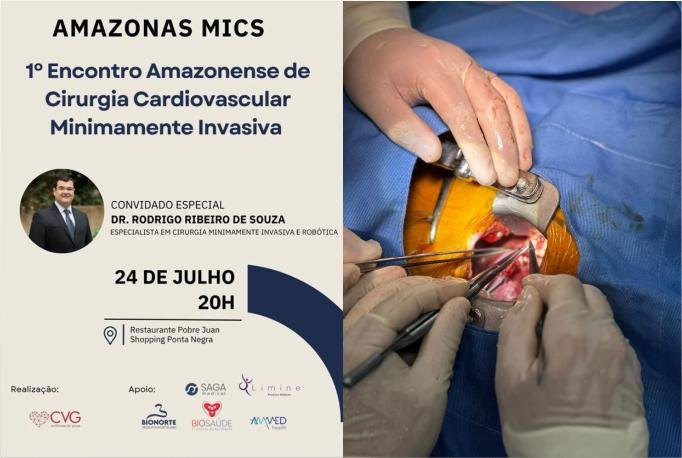Manaus sedia 1º Encontro Amazonense de Cirurgia Cardiovascular Minimamente Invasiva